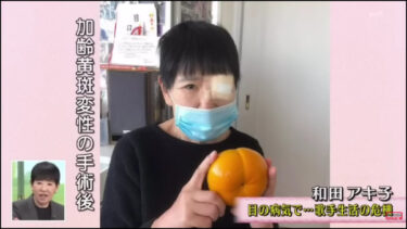 和田アキ子が患った病気や手術は？現在の体調は大丈夫なのか？